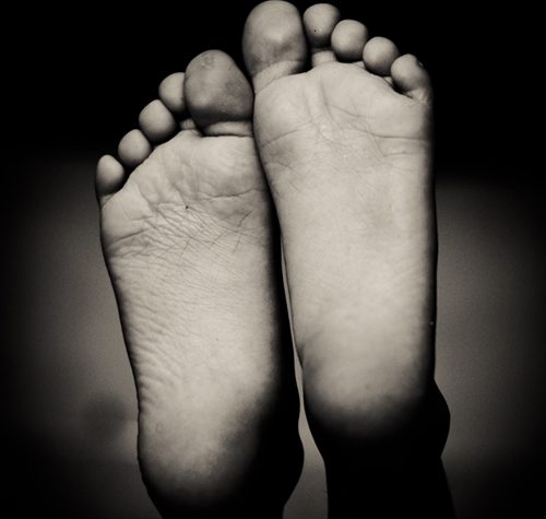 Flat Feet illustration