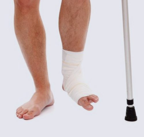 Foot Fractures illustration