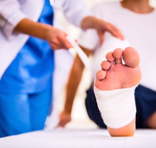 Plantar Fasciitis illustration